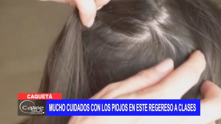 Mucho cuidados con los piojos en este regereso a clases